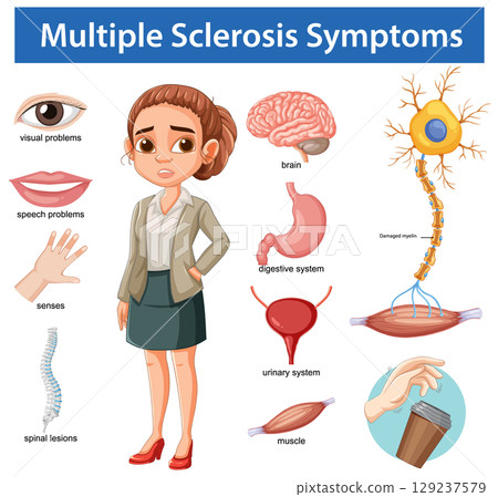 Illustrated Guide to Multiple Sclerosis Symptoms in Adults Illustrated Guide to Multiple Sclerosis Symptoms in Adults 129237579