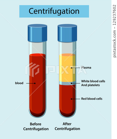 Blood Separation in Test Tubes by Centrifugation 129237602