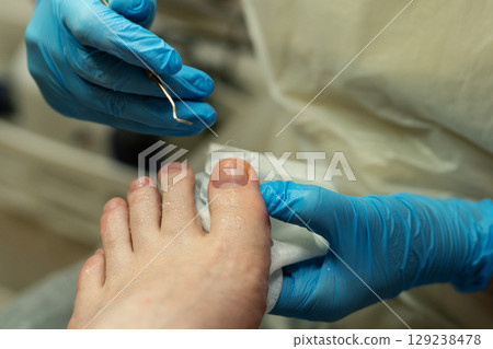 Detail view of toenail cleaning with probe during pedicure session. Detail view of toenail cleaning with probe during pedicure session. 129238478