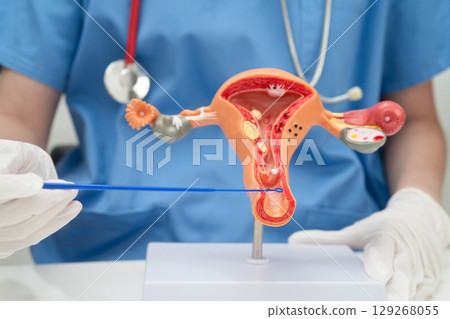 Doctor holding human uterus model for vaginal and cervix pap smear check up in the obstetrics and gynecology. 129268055