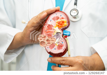 Kidney disease, Chronic kidney disease ckd, Doctor hold human model to treat and study in hospital. 129268147