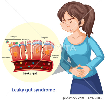 Woman Experiencing Leaky Gut Syndrome with Medical Diagram 129270033
