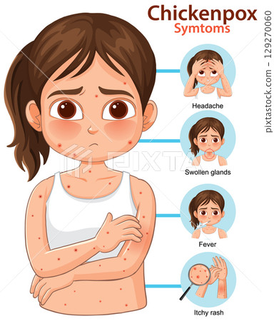 Chickenpox Symptoms in Child Vector Illustration 129270060