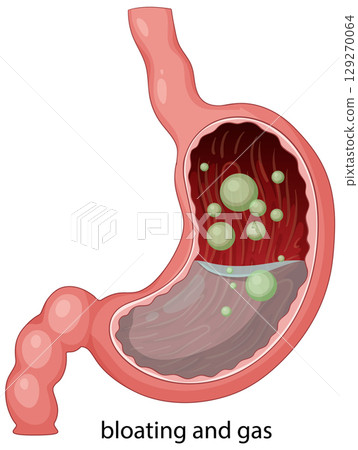 Human Stomach with Gas Bubbles Illustration 129270064