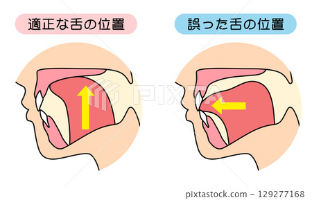 How to mew properly: correct and incorrect tongue position 129277168