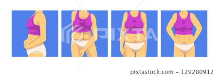 Female Torso with Sagging Belly and Soft Muscles Vector Set 129280912