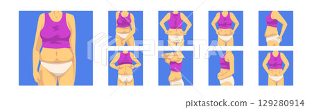 Female Torso with Sagging Belly and Soft Muscles Vector Set 129280914