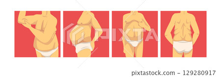 Male Torso with Sagging Belly and Soft Muscles Vector Set 129280917