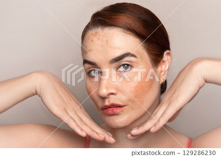 Beautiful woman face with pigmentation, melasma, freckles, age spots photo Beautiful woman face with pigmentation, melasma, freckles, age spots photo 129286230