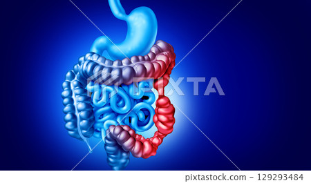 IBS Symptoms 129293484