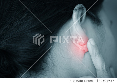 Close-up of skin infection behind the ear showing redness, inflammation, and irritation. Dermatological problem, eczema or fungal infection concept. Medical skincare issue. 129304637