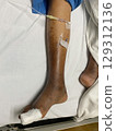 Injured Leg with IV 129312136