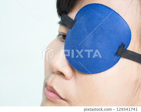 Woman Eye patch Pterygium Surgery Eye Medical Health Protection Wind and Sunshine, Medicine Care Patient After Pterygium Excision of Doctor Oculist Hospital,Old Human Problem Vision Disease Lens Iris. 129341741