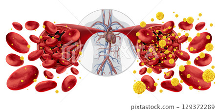 Diabetes Symptoms 129372289