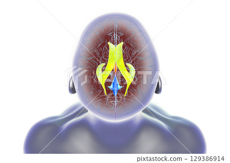 Human brain with colored ventricles, 3D illustration 129386914