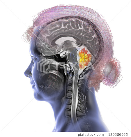 Cerebellum MRI, illustration 129386935