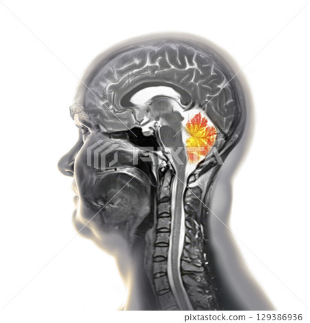 Cerebellum MRI, illustration 129386936