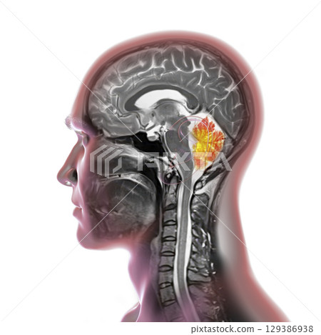 Cerebellum MRI, illustration Cerebellum MRI, illustration 129386938