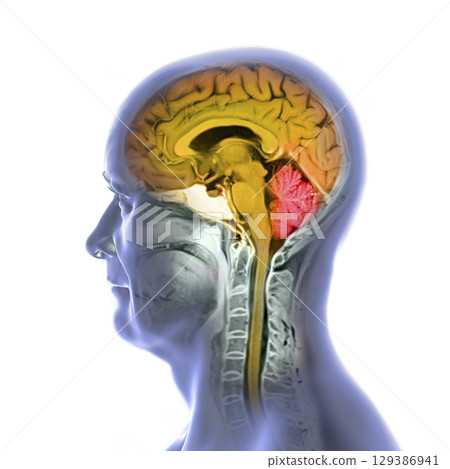 Brain anatomy MRI, illustration Brain anatomy MRI, illustration 129386941