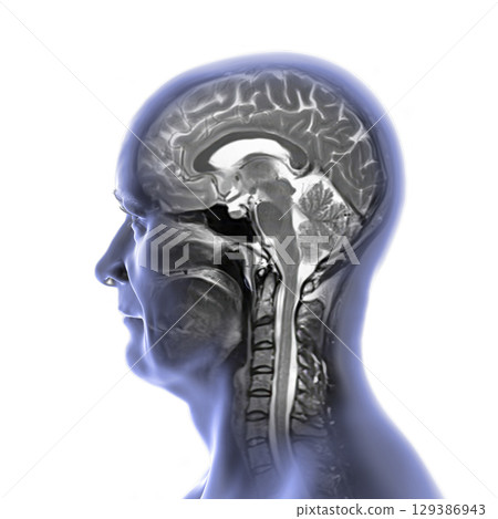 Brain anatomy MRI, illustration 129386943