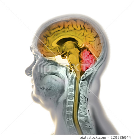 Brain anatomy MRI, illustration 129386944