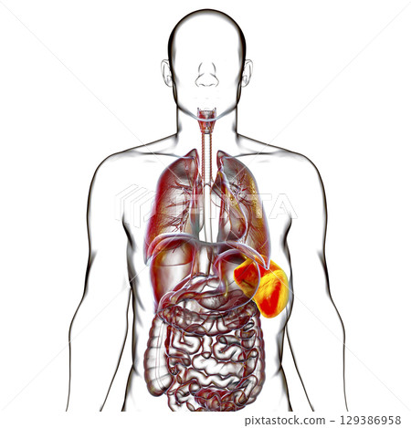Splenomegaly, 3D illustration 129386958