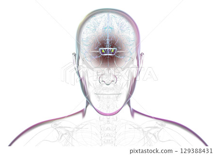 Human brain with degenerated substantia nigra in Parkinson's disease, 3D illustration. 129388431