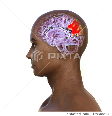 Human brain with highlighted precuneus gyrus, 3D illustration Human brain with highlighted precuneus gyrus, 3D illustration 129388587