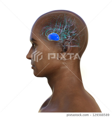 Human brain with highlighted putamen, a key basal ganglia structure involved in motor control and learning, 3D illustration. Human brain with highlighted putamen, a key basal ganglia structure involved in motor control and learning, 3D illustration. 129388589