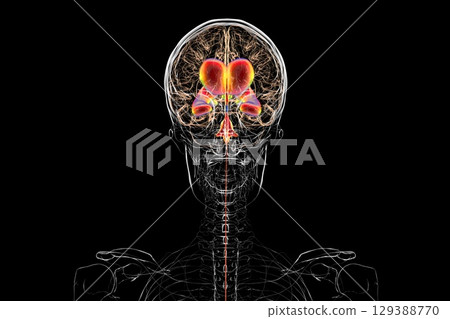 Normal pressure hydrocephalus, 3D illustration Normal pressure hydrocephalus, 3D illustration 129388770
