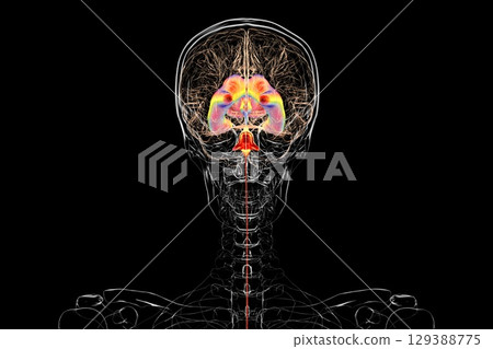 Normal pressure hydrocephalus, 3D illustration 129388775