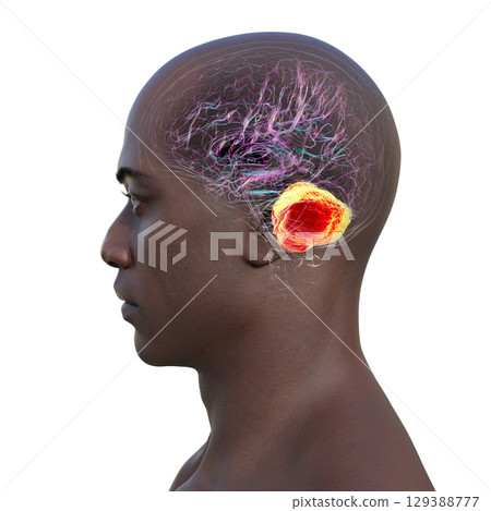 Human brain with highlighted cerebellum, 3D illustration Human brain with highlighted cerebellum, 3D illustration 129388777
