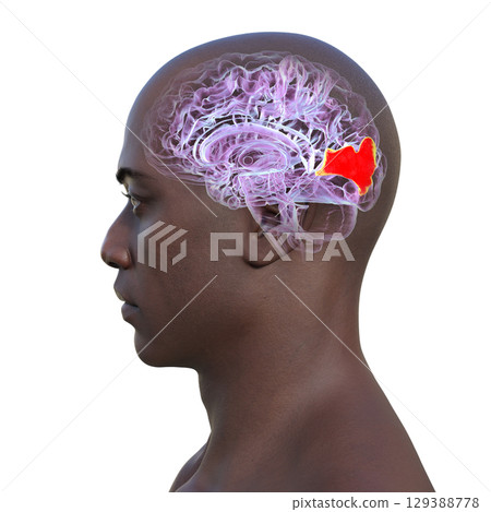 Human brain with highlighted cuneus gyrus, 3D illustration 129388778