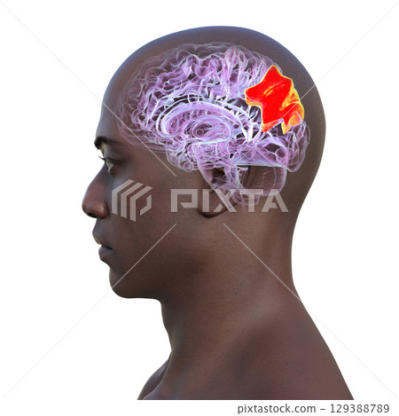 Human brain with highlighted precuneus gyrus, 3D illustration Human brain with highlighted precuneus gyrus, 3D illustration 129388789