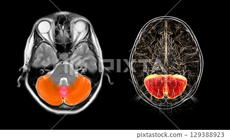 Cerebellum MRI scan, illustration 129388923
