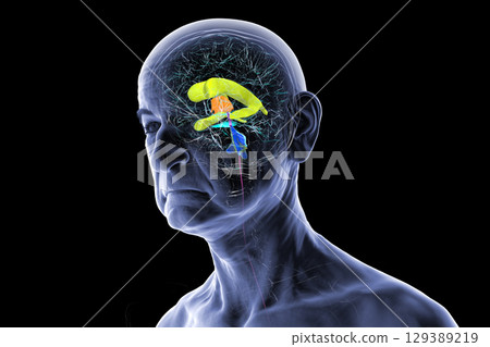 Human brain with colored ventricles, 3D illustration, lateral (yellow), third (orange), fourth (blue), interventricular foramen (green), cerebral aqueduct (dark purple), spinal channel (light purple). 129389219