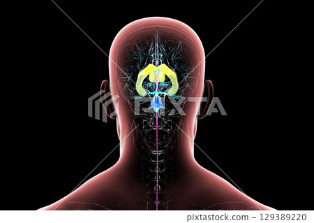 Human brain with colored ventricles, 3D illustration, lateral (yellow), third (orange), fourth (blue), interventricular foramen (green), cerebral aqueduct (dark purple), spinal channel (light purple). 129389220