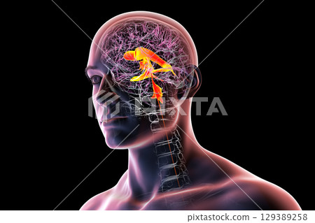 Ventricular system of the brain, 3D illustration 129389258