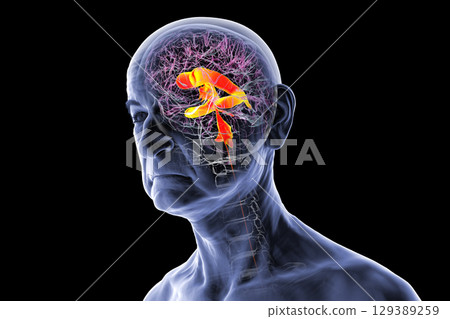 Ventricular system of the brain, 3D illustration Ventricular system of the brain, 3D illustration 129389259