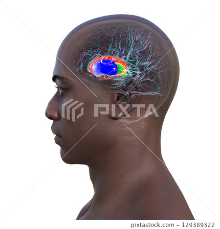 Basal ganglia, 3D illustration Basal ganglia, 3D illustration 129389322