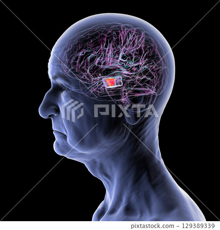 Human brain with highlighted substantia nigra, 3D illustration. 129389339