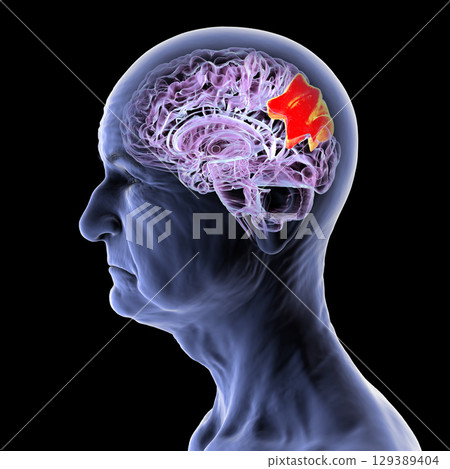 Human brain with highlighted precuneus gyrus, 3D illustration Human brain with highlighted precuneus gyrus, 3D illustration 129389404