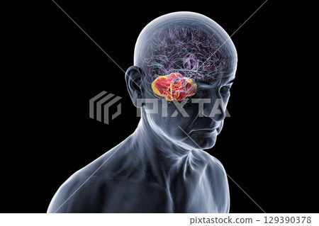 Human brain with highlighted cerebellum, 3D illustration Human brain with highlighted cerebellum, 3D illustration 129390378