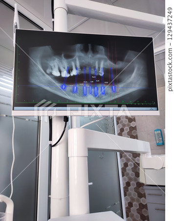 Detailed dental CT scan showing axial, coronal, sagittal, and 3D views of jaw and teeth for diagnostic and treatment plan 129437249