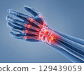 X-ray of wrist showing pain areas medical imaging clinical analysis anatomical study close-up view health concerns 129439059