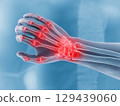 X-ray of wrist with pain indications medical imaging clinical environment detailed viewpoint for diagnostic analysis 129439060