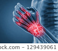 X-ray of wrist with red pain areas medical imaging healthcare clinical analysis close-up view anatomy insights 129439061