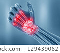 X-ray of wrist revealing red pain areas medical imaging clinical environment close-up view health insights 129439062