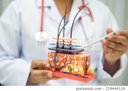 Hair transplant, Asian dermatologist doctor holding skin structure anatomy model for treatment in hospital. 129444124