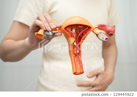 Asian woman holding human uterus anatomy model. 129445922